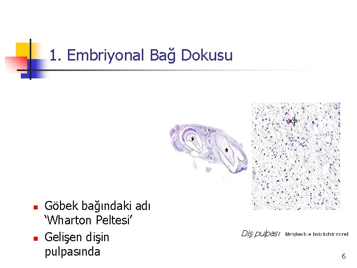 1. Embriyonal Bağ Dokusu n n Göbek bağındaki adı ‘Wharton Peltesi’ Gelişen dişin pulpasında