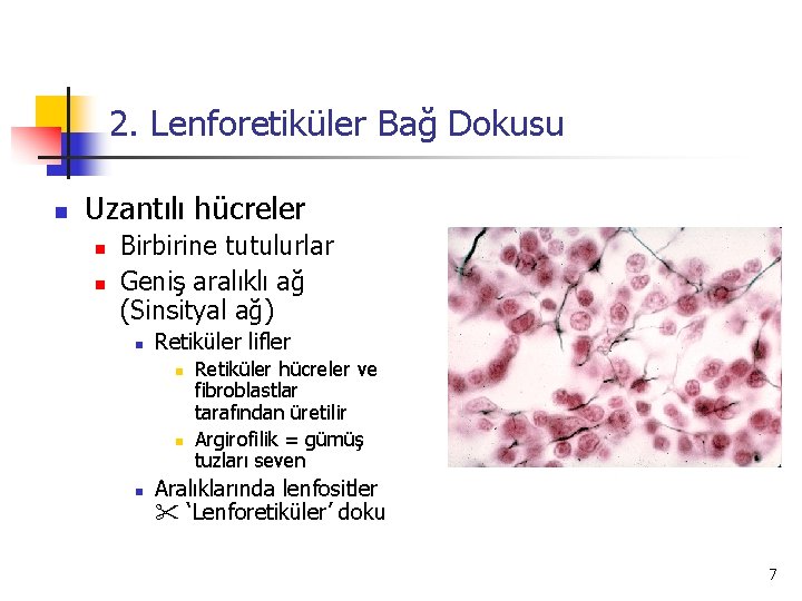 2. Lenforetiküler Bağ Dokusu n Uzantılı hücreler n n Birbirine tutulurlar Geniş aralıklı ağ