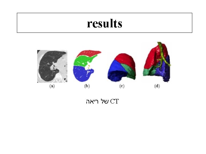 results של ריאה CT 