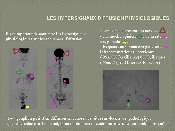 LES HYPERSIGNAUX DIFFUSION PHYSIOLOGIQUES Il est important de connaitre les hypersignaux physiologiques sur les