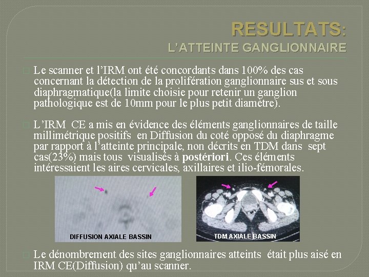 RESULTATS: L’ATTEINTE GANGLIONNAIRE � Le scanner et l’IRM ont été concordants dans 100% des