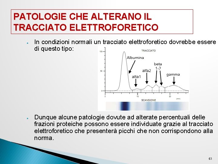 PATOLOGIE CHE ALTERANO IL TRACCIATO ELETTROFORETICO ● ● In condizioni normali un tracciato elettroforetico PATOLOGIE CHE ALTERANO IL TRACCIATO ELETTROFORETICO ● ● In condizioni normali un tracciato elettroforetico