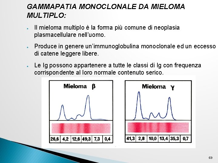 GAMMAPATIA MONOCLONALE DA MIELOMA MULTIPLO: ● ● ● Il mieloma multiplo è la forma GAMMAPATIA MONOCLONALE DA MIELOMA MULTIPLO: ● ● ● Il mieloma multiplo è la forma