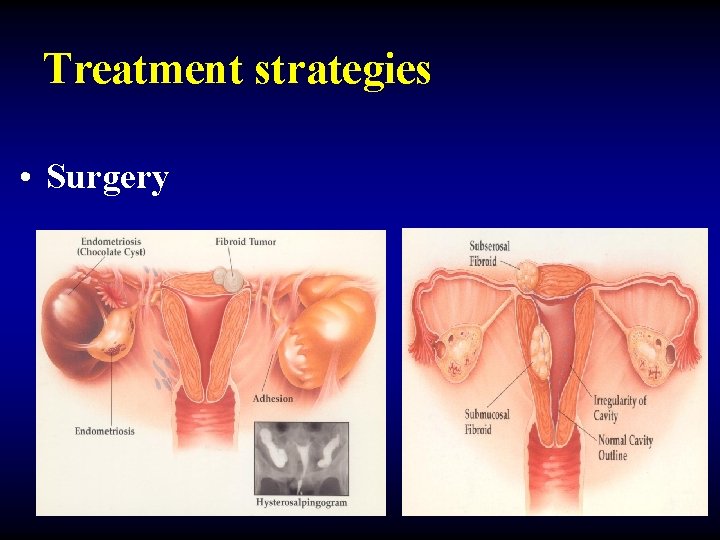 Treatment strategies • Surgery 