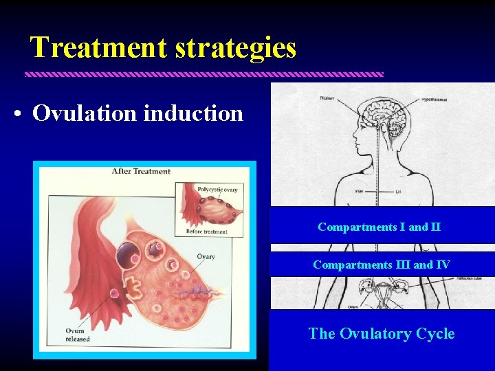 Treatment strategies • Ovulation induction Compartments I and II Compartments III and IV The