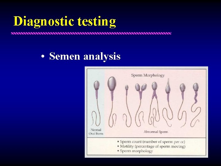 Diagnostic testing • Semen analysis 
