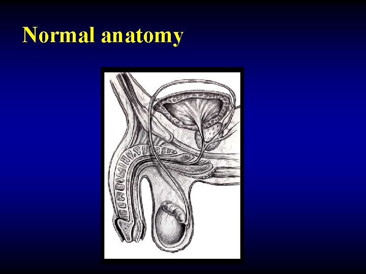 Normal anatomy 