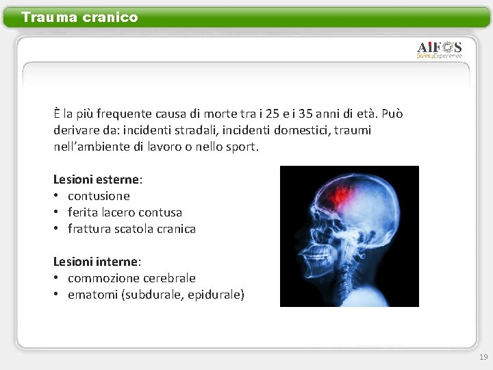 Trauma cranico È la più frequente causa di morte tra i 25 e i