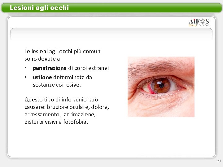 Lesioni agli occhi Le lesioni agli occhi più comuni sono dovute a: • penetrazione