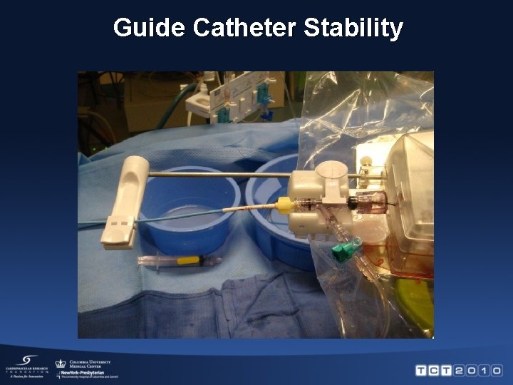 Guide Catheter Stability 