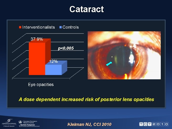 Cataract p<0. 005 A dose dependent increased risk of posterior lens opacities Kleiman NJ,