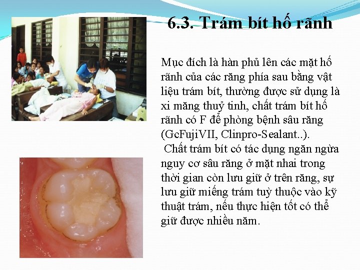 6. 3. Trám bít hố rãnh Mục đích là hàn phủ lên các mặt