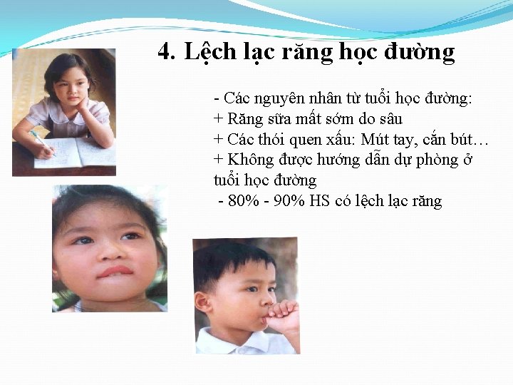 4. Lệch lạc răng học đường - Các nguyên nhân từ tuổi học đường: