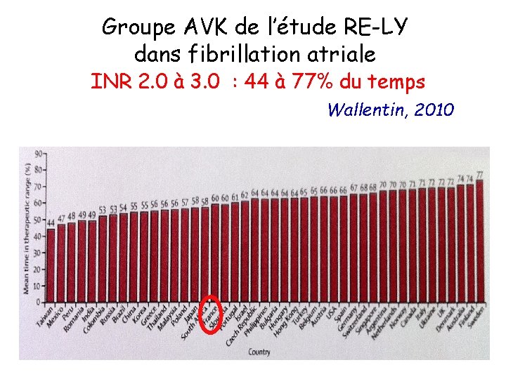 Groupe AVK de l’étude RE-LY dans fibrillation atriale INR 2. 0 à 3. 0