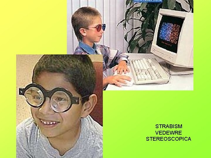 STRABISM VEDEWRE STEREOSCOPICA 