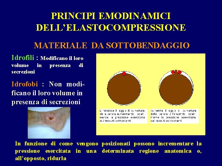 PRINCIPI EMODINAMICI DELL’ELASTOCOMPRESSIONE MATERIALE DA SOTTOBENDAGGIO Idrofili : Modificano il loro volume in secrezioni