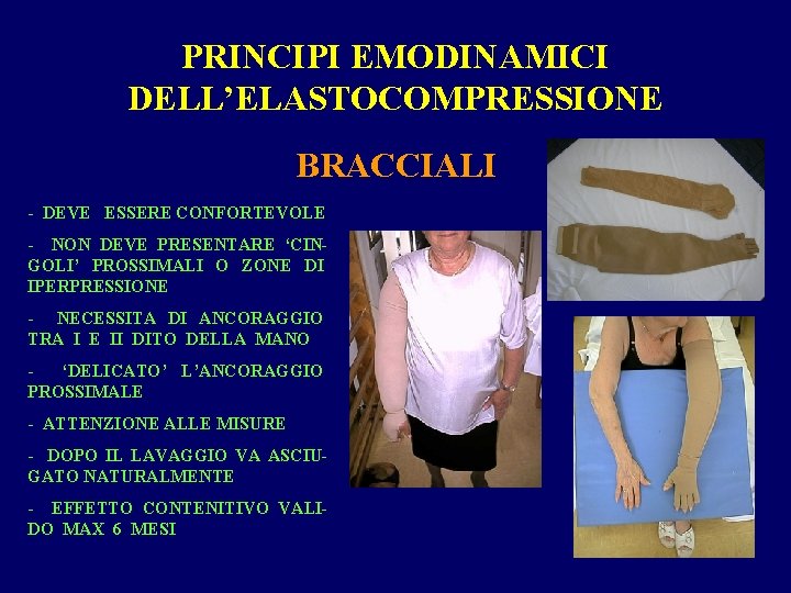 PRINCIPI EMODINAMICI DELL’ELASTOCOMPRESSIONE BRACCIALI - DEVE ESSERE CONFORTEVOLE - NON DEVE PRESENTARE ‘CINGOLI’ PROSSIMALI