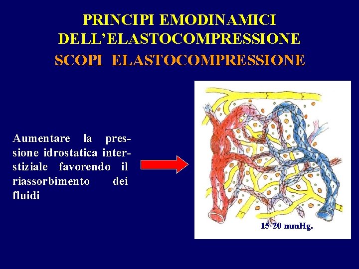 PRINCIPI EMODINAMICI DELL’ELASTOCOMPRESSIONE SCOPI ELASTOCOMPRESSIONE Aumentare la pressione idrostatica interstiziale favorendo il riassorbimento dei