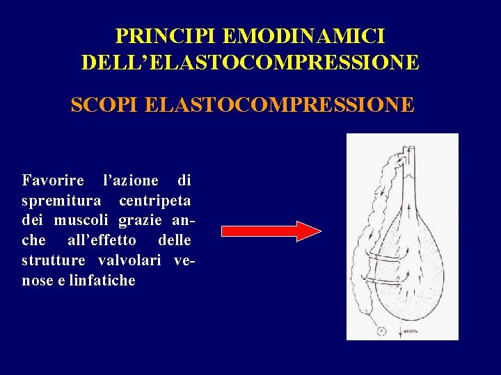 PRINCIPI EMODINAMICI DELL’ELASTOCOMPRESSIONE SCOPI ELASTOCOMPRESSIONE Favorire l’azione di spremitura centripeta dei muscoli grazie anche