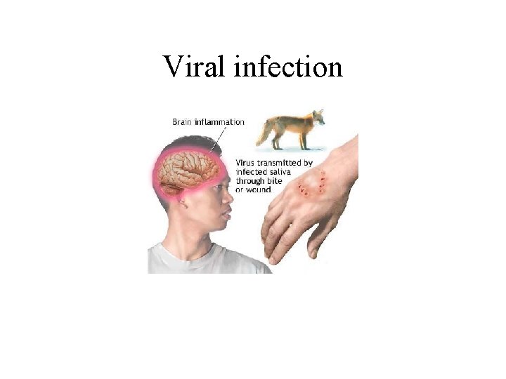 Viral infection 