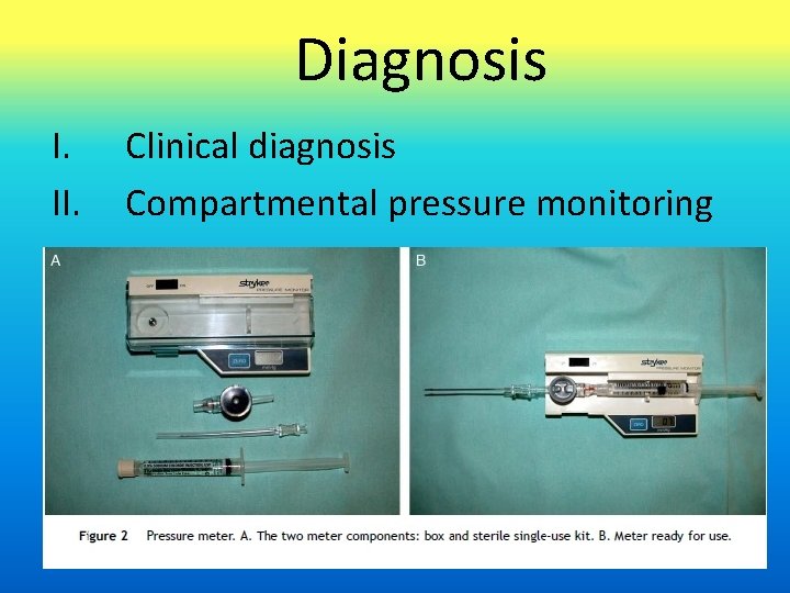 Diagnosis I. II. Clinical diagnosis Compartmental pressure monitoring 