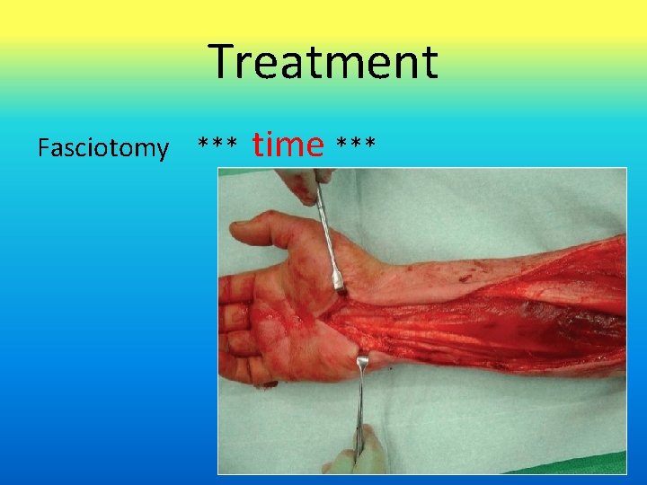 Treatment Fasciotomy *** time *** 