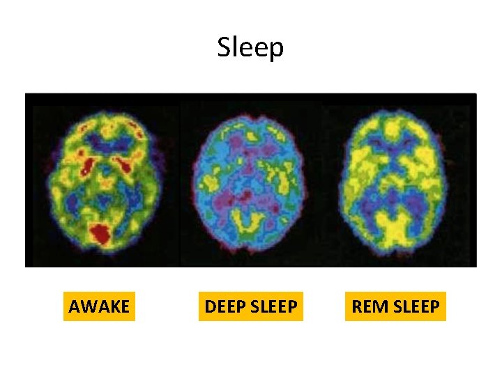 Sleep AWAKE DEEP SLEEP REM SLEEP 