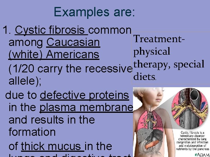 Examples are: 1. Cystic fibrosis common Treatmentamong Caucasian physical (white) Americans therapy, special (1/20