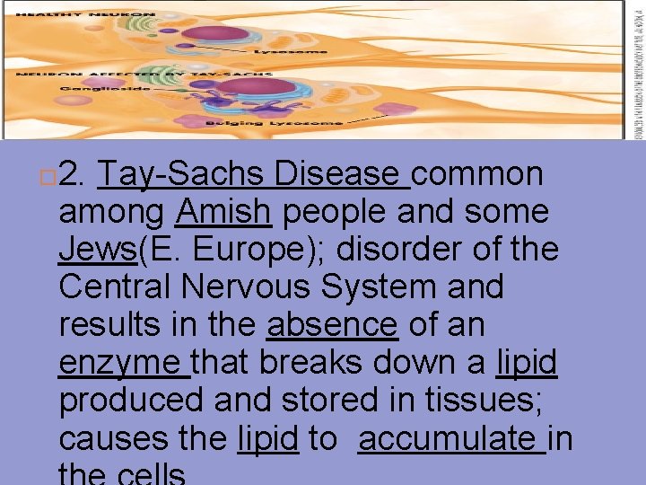  2. Tay-Sachs Disease common among Amish people and some Jews(E. Europe); disorder of