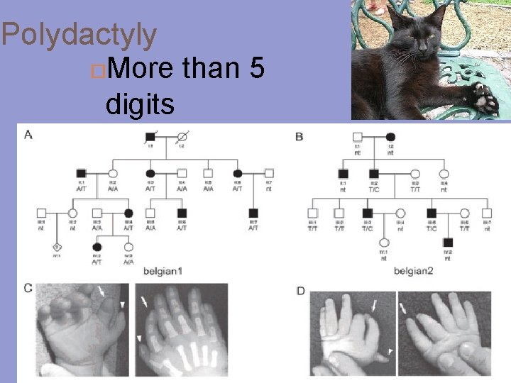 Polydactyly More than 5 digits 