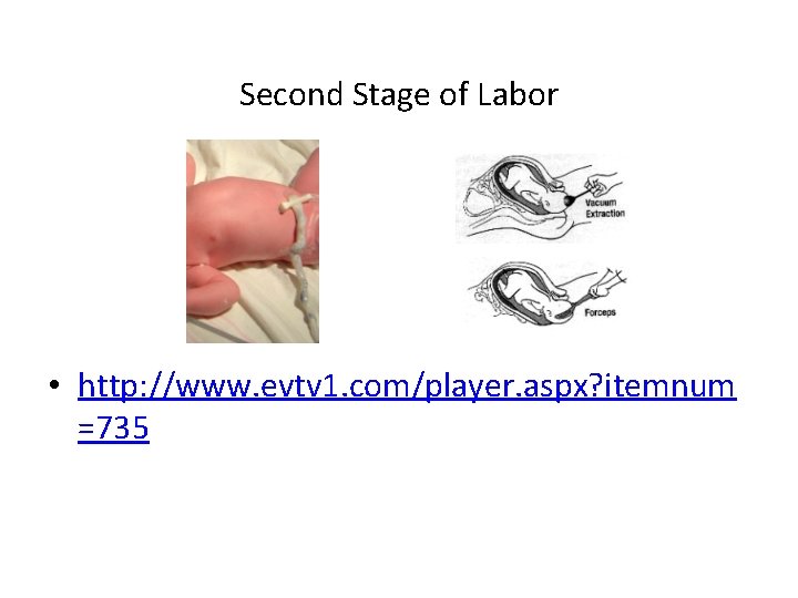 Second Stage of Labor • http: //www. evtv 1. com/player. aspx? itemnum =735 