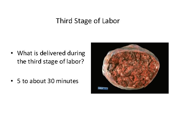 Third Stage of Labor • What is delivered during the third stage of labor?