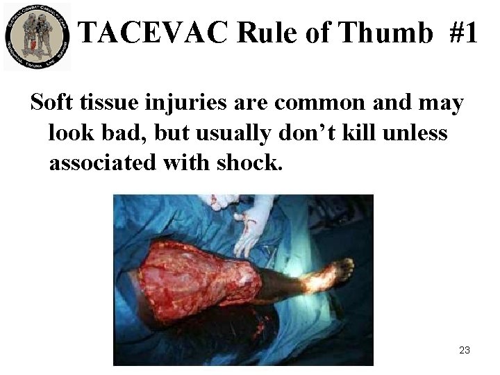 TACEVAC Rule of Thumb #1 Soft tissue injuries are common and may look bad,