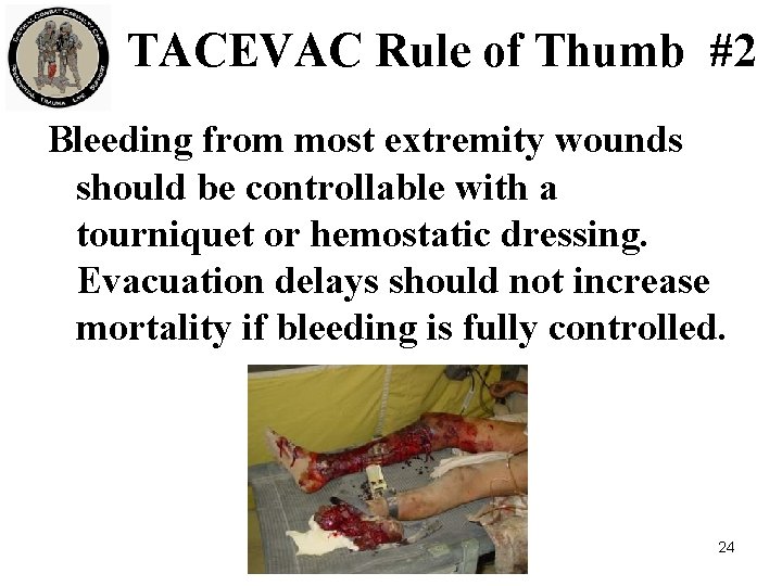 TACEVAC Rule of Thumb #2 Bleeding from most extremity wounds should be controllable with