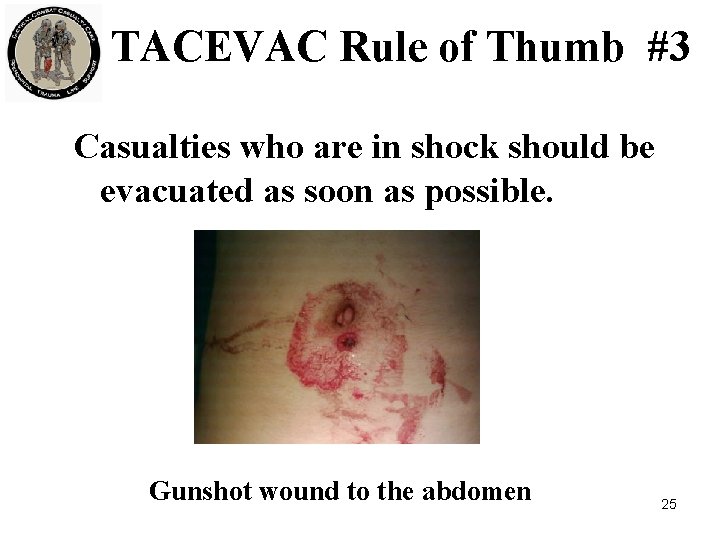 TACEVAC Rule of Thumb #3 Casualties who are in shock should be evacuated as