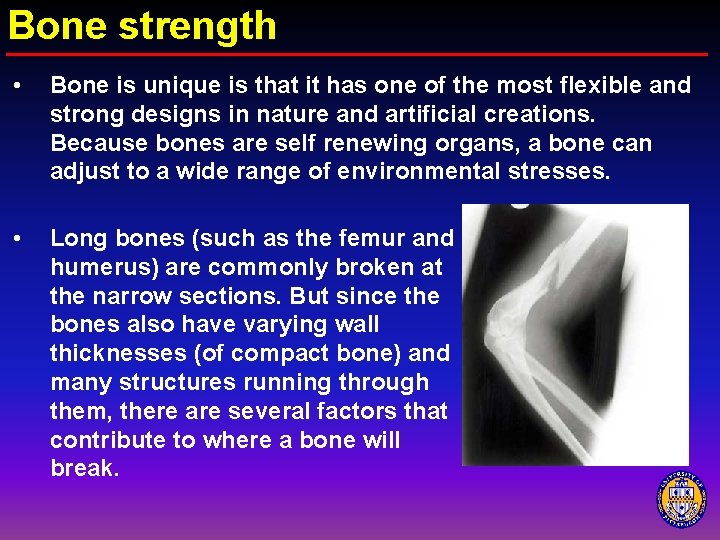 Bone strength • Bone is unique is that it has one of the most