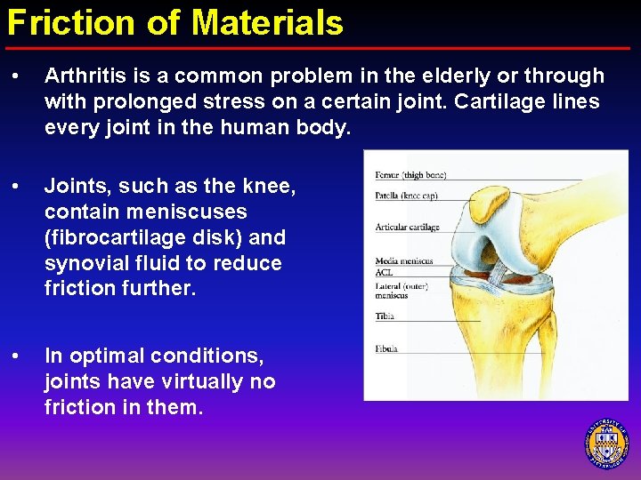 Friction of Materials • Arthritis is a common problem in the elderly or through
