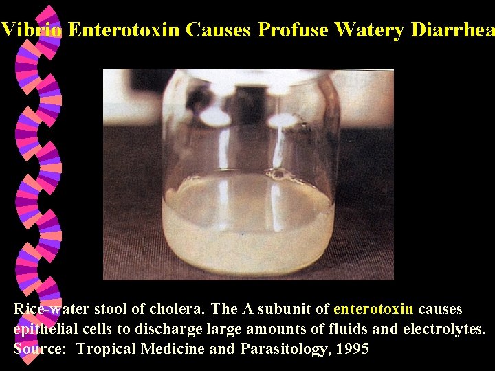 Vibrio Enterotoxin Causes Profuse Watery Diarrhea Rice-water stool of cholera. The A subunit of