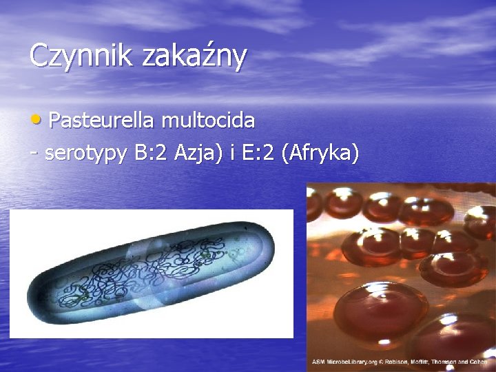 Czynnik zakaźny • Pasteurella multocida - serotypy B: 2 Azja) i E: 2 (Afryka)