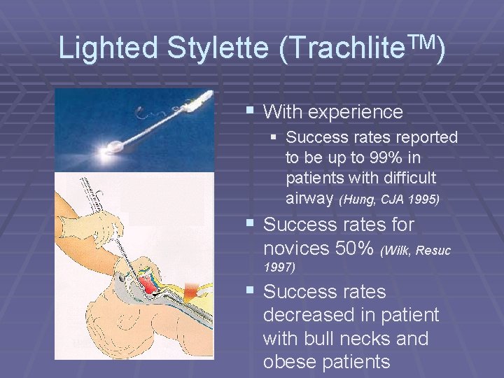 Lighted Stylette (Trachlite. TM) § With experience § Success rates reported to be up