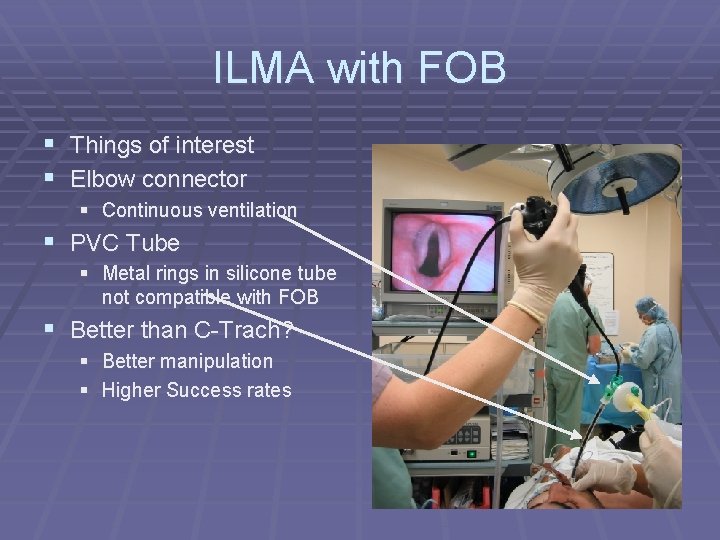 ILMA with FOB § Things of interest § Elbow connector § Continuous ventilation §