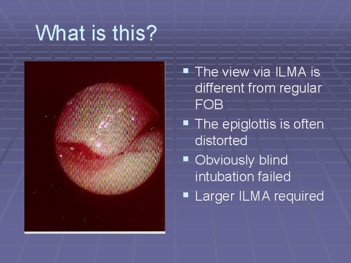 What is this? § The view via ILMA is different from regular FOB §