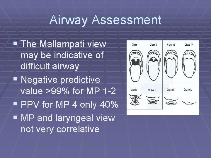 Airway Assessment § The Mallampati view may be indicative of difficult airway § Negative