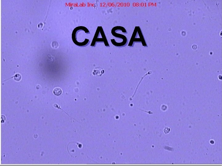 CASA 