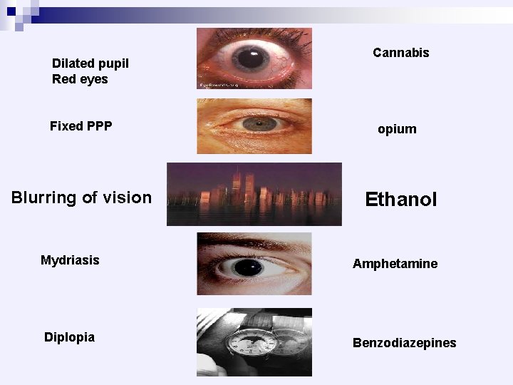 Dilated pupil Red eyes Fixed PPP Blurring of vision Cannabis opium Ethanol Mydriasis Amphetamine