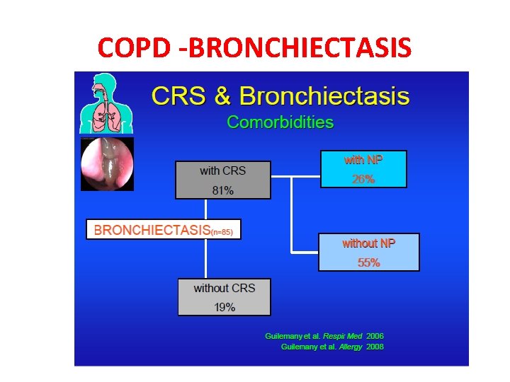COPD -BRONCHIECTASIS 