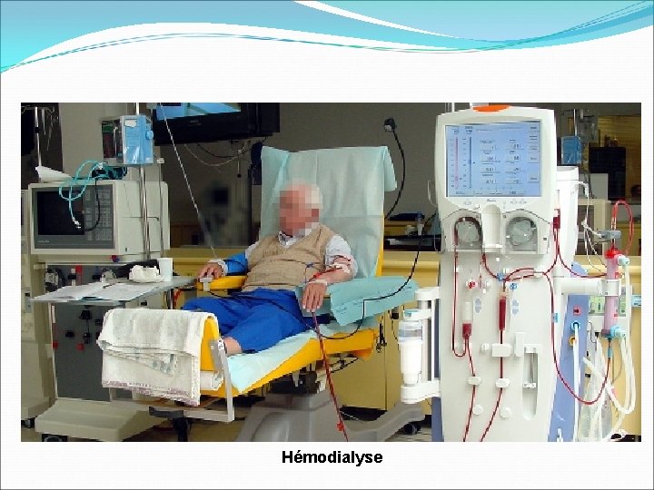 Hémodialyse 