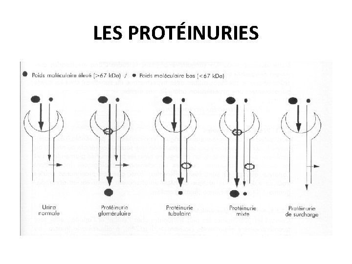 LES PROTÉINURIES 