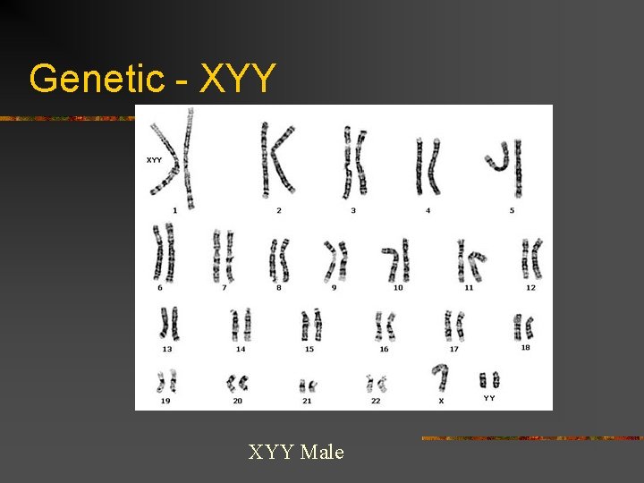 Genetic - XYY Male 