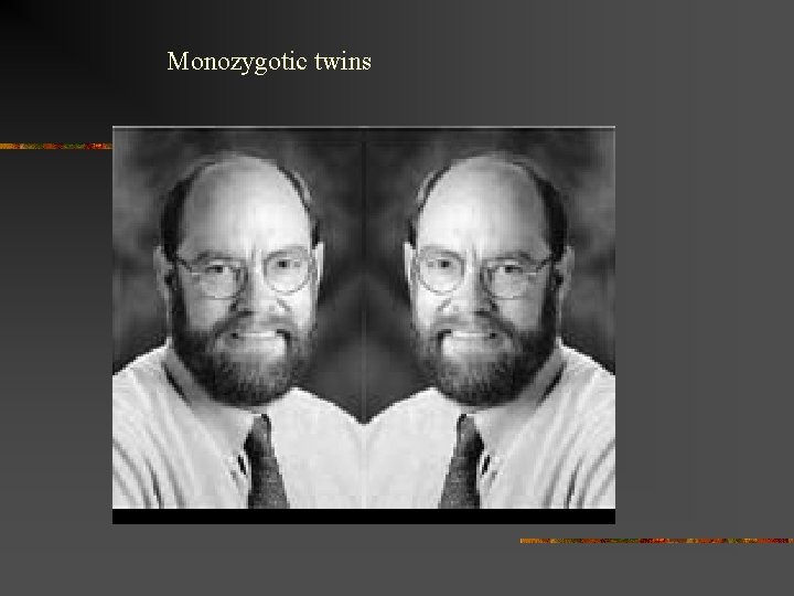 Monozygotic twins 